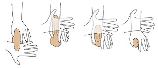 la técnica de alargamiento del pene